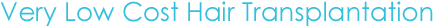 Very Low Cost Hair Transplantation Very Low Cost Hair Transplantation