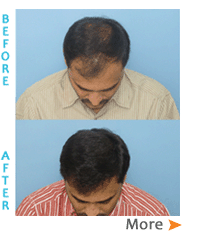 Oliva Skin & Hair Clinic - Hair Transplantation Clinic in Hyderabad,Telangana  | Pointlocals